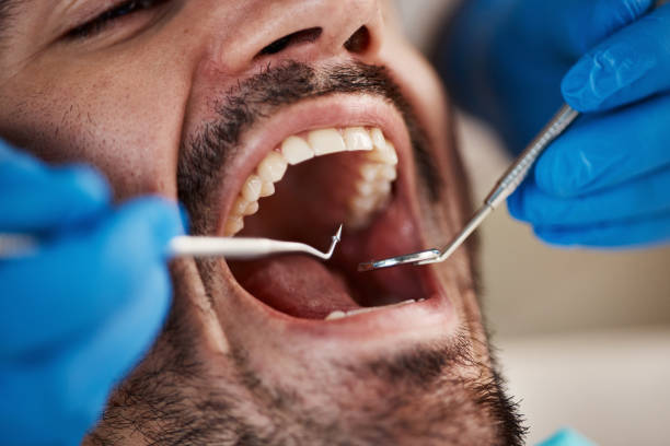 Best Knocked-Out Tooth Emergency  in Chandler, AZ